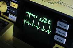 Monitor des Defibrillators 