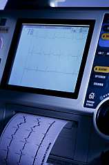 Herzfrequenzüberwachung auf Monitor